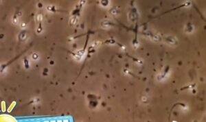 Hebat, Kini Sperma Bisa Menaiki ‘Taksi’ Agar Bisa Sampai ke Ovum Dengan Cepat