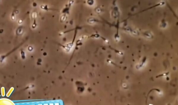 Hebat, Kini Sperma Bisa Menaiki ‘Taksi’ Agar Bisa Sampai ke Ovum Dengan Cepat