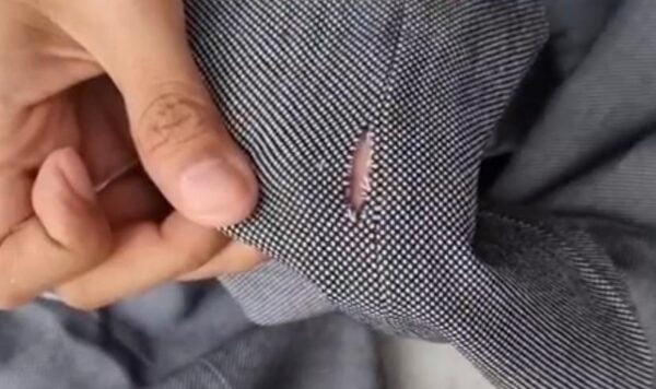 9 Cara Menjahit Baju Sobek, Solusi Mudah untuk Busana yang Rusak