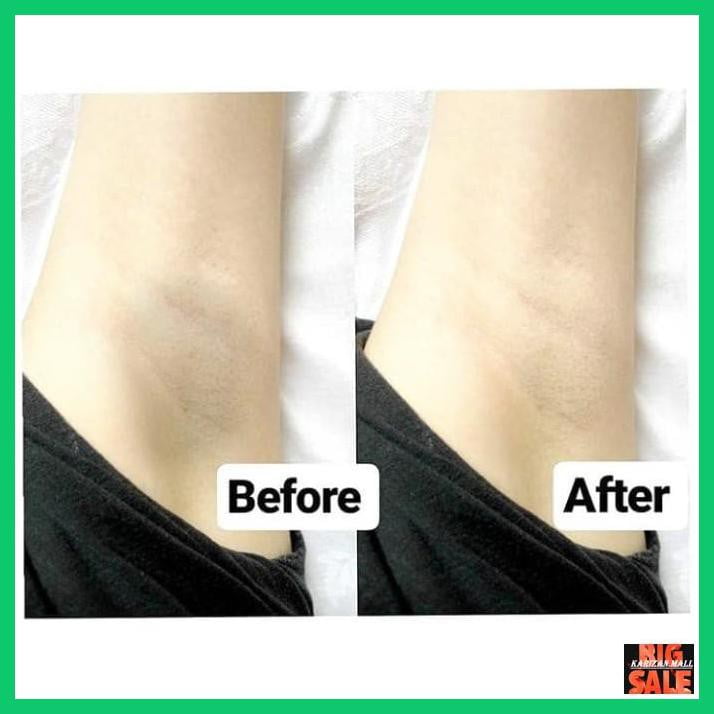 Nature Republic Cotton Armpit Kit, Rahasia Kulit Ketiak Cerah dan Bebas Bau