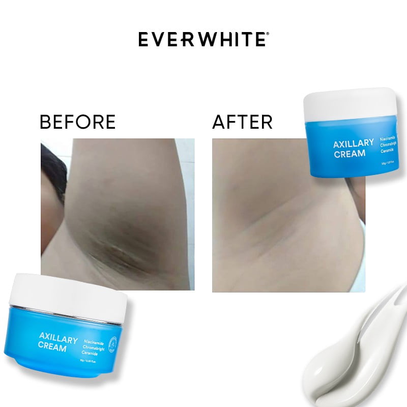 Nature Everwhite Axillary Cream, Rahasia Cantik di Ketiak yang Menggoda