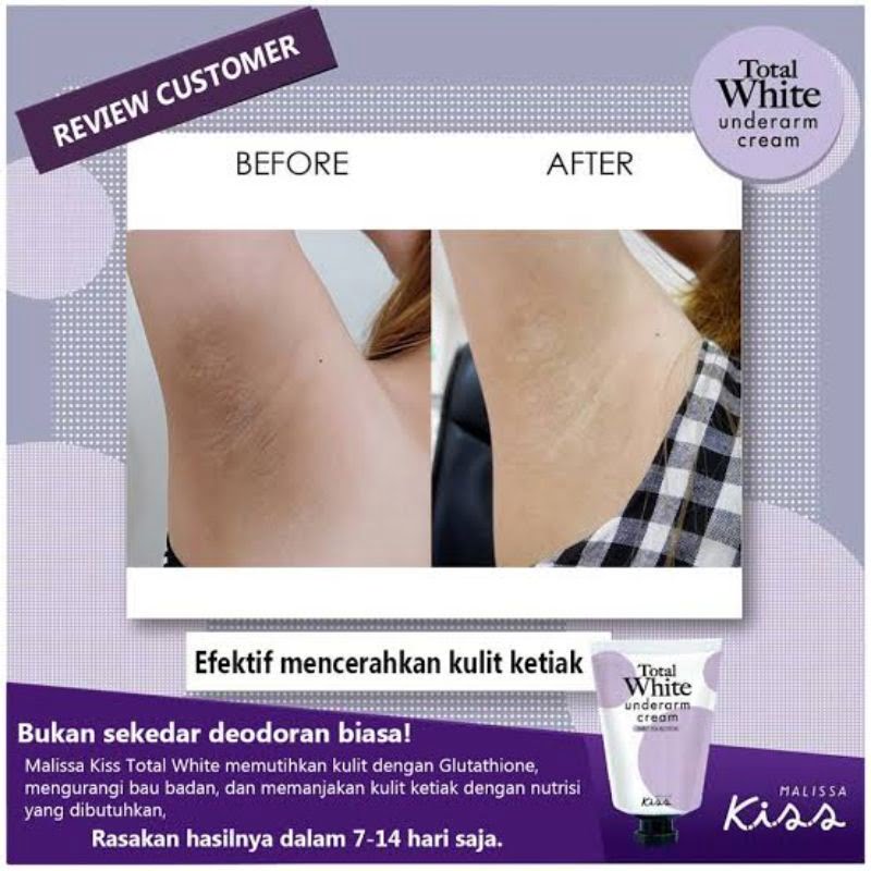 Malissa Kiss Underarm Cream Solusi Utama untuk Ketek Halus dan Cantik
