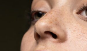 Cara Luar Biasa untuk Menghilangkan Flek Hitam: Gunakan Rahasia Gula Pasir Murah Ini dan Rasakan Keajaibannya! Wajah Glowing Cerah Terbongkar!