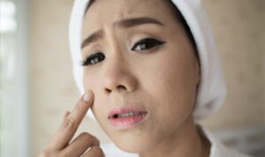 Cara Menggunakan Umbi-Umbian Tunggal untuk Mengurangi Kerutan dan Garis Halus pada Wajah Anda