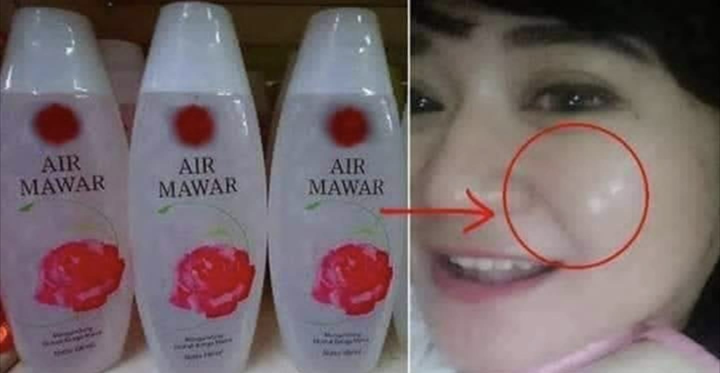 Siap-siap Terkejut! 8 Manfaat Air Mawar Viva yang Bikin Kamu Terpesona!