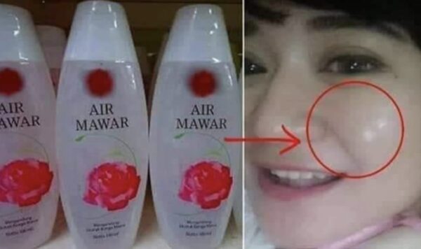 Trik Ampuh Menghilangkan Flek Hitam dengan Menggunakan Air Mawar Viva! Hanya 6 Rb untuk Kulit Cantikmu! Jangan Lewatkan!