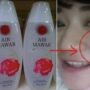 Trik Ampuh Menghilangkan Flek Hitam dengan Rahasia Air Mawar Viva! Hanya 6 Rb untuk Kulit Cantikmu! Jangan Lewatkan!