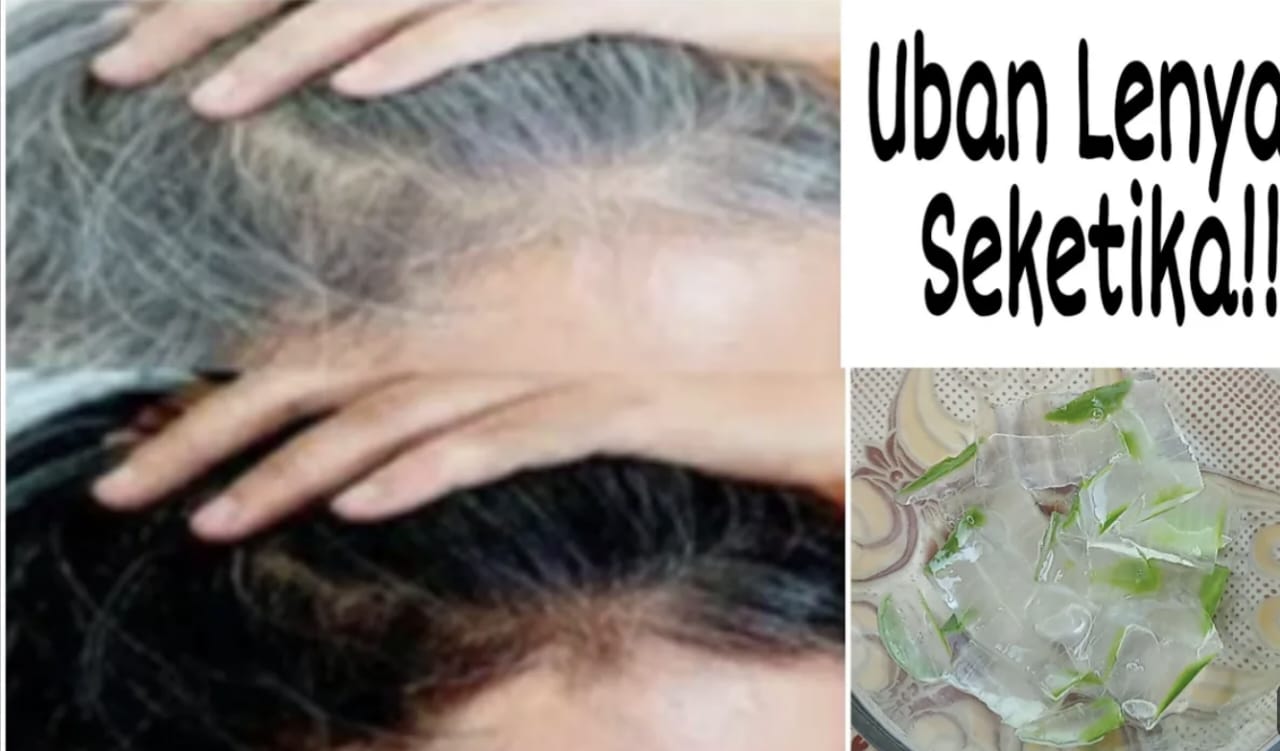 3 Merk Produk Lidah Buaya untuk Rambut Uban yang Tersedia di Indomaret, Solusi Cepat Menghilangkan Rambut Putih!