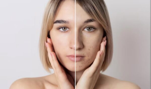 3 Tips Memperlambat Penuaan Kulit dengan Bahan Alami untuk Kulit yang Kencang dan Bebas Keriput