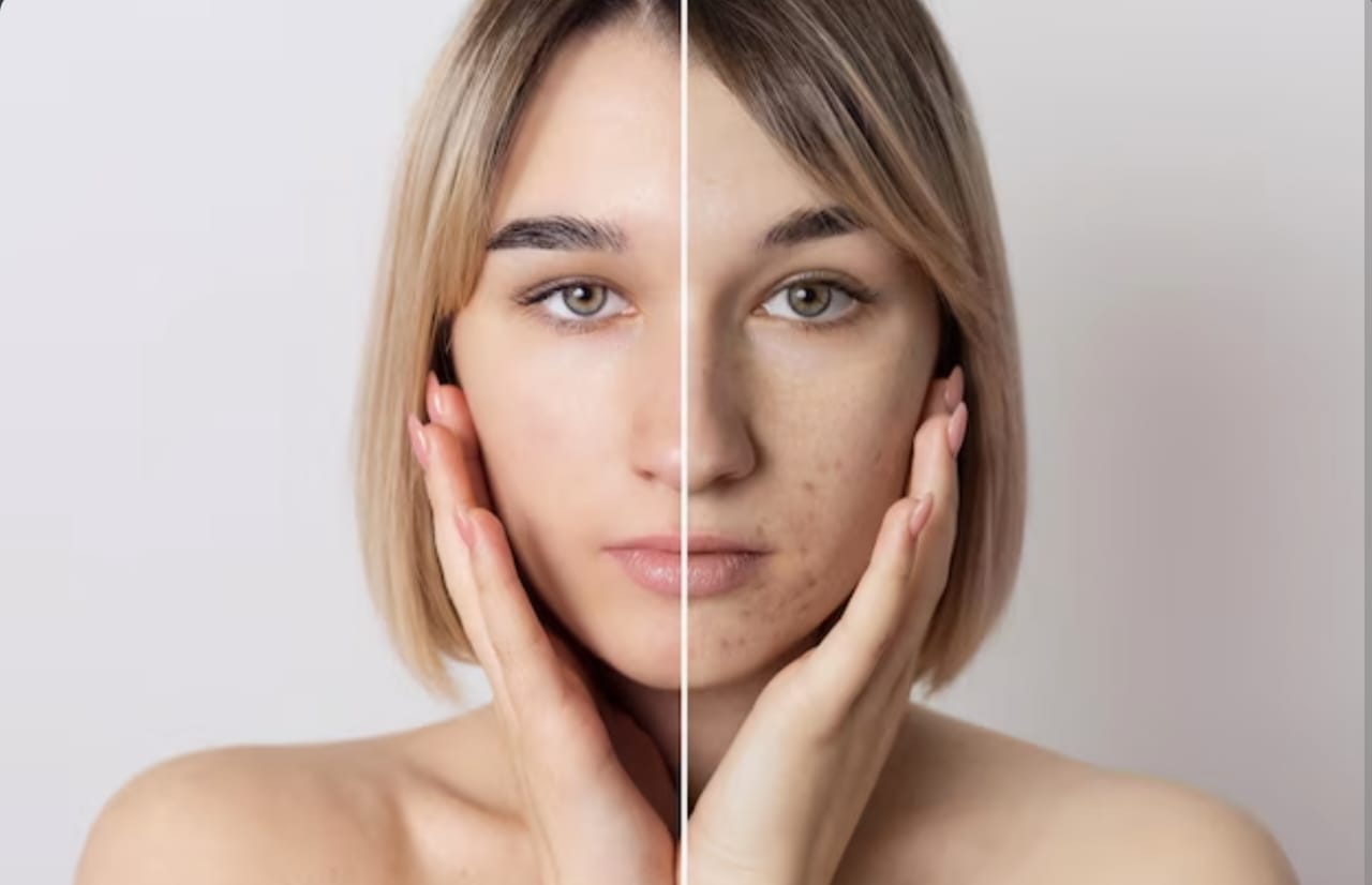 3 Tips Memperlambat Penuaan Kulit dengan Bahan Alami untuk Kulit yang Kencang dan Bebas Keriput