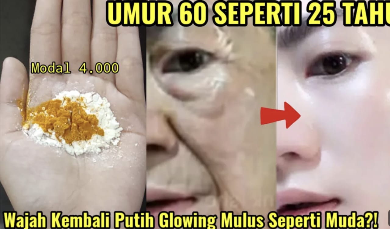 4 Krim Terbaik untuk Menghilangkan Kerutan di Wajah, Efektif Memudarkan Flek Hitam, dan Membuat Kulit Glowing!