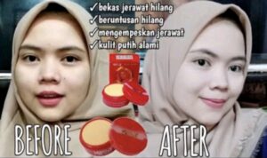 Bedak Kelly Siang Malam: Rahasia Kecantikan untuk Kulit Anda yang Bercahaya