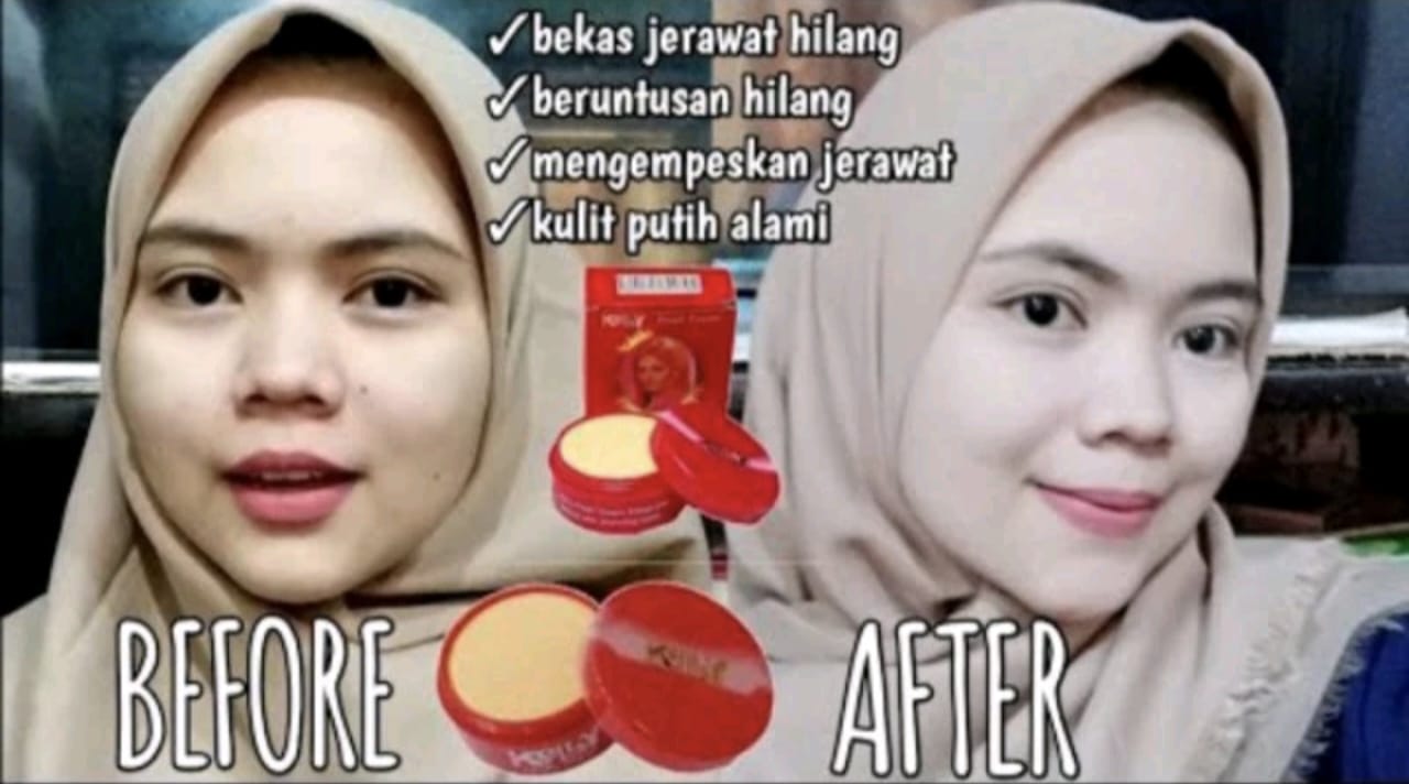 Bedak Kelly Siang Malam Rahasia Kecantikan untuk Kulit Anda yang Bercahaya