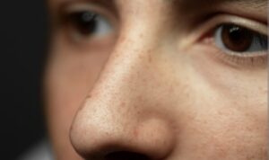 Cara Efektif Menghilangkan Noda dan Flek Hitam Membandel dengan Penggunaan Krim Kelly untuk Kulit yang Lebih Bersih, Cerah, dan Glowing