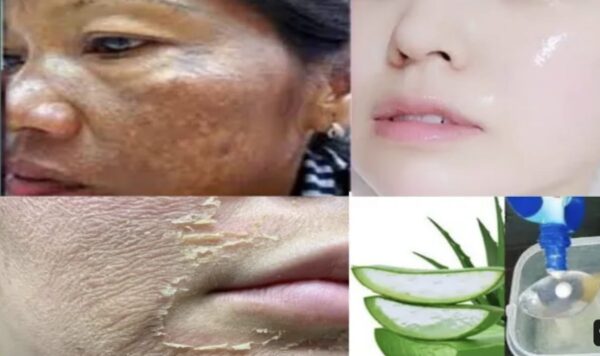Dapatkan Kulit Wajah yang Super Kencang dan Bebas Flek Hitam dengan Rahasia Masker Lidah Buaya! Trik Ampuh Wajah Cerah dalam Sekejap!