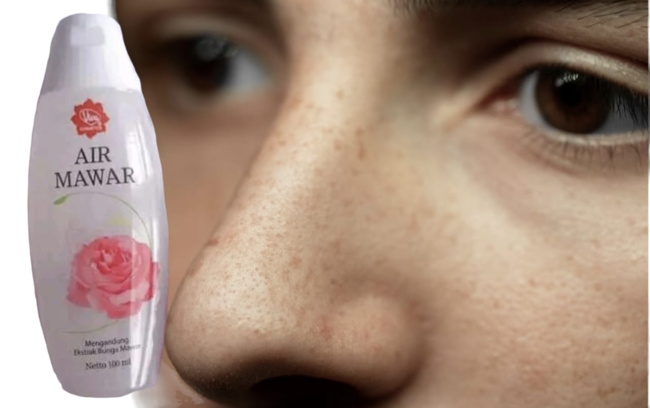 Inilah 5 Tips Rahasia untuk Wajah Putih Glowing dan Bebas Flek Hitam dengan Masker Air Mawar Viva Sebelum Tidur! Tidak Percaya Temukan Cara Bikinnya di Sini!
