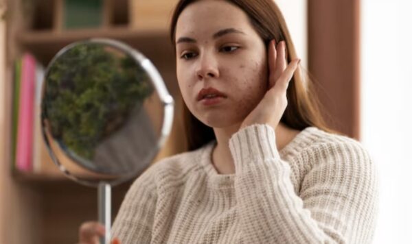 Kulit Wajah Tidak Merata, 8 Tips Ahli Kecantikan untuk Kulit yang Sehat dan Bersinar