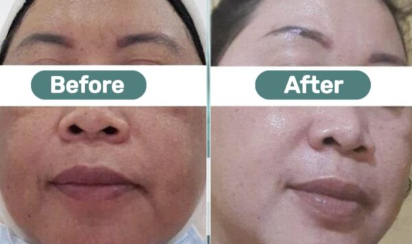 Merk Sabun Muka Batangan Terbaik untuk Memutihkan Wajah! Dengan Harga Mulai dari 10 Ribu, Anda Bisa Dapatkan Kulit Wajah yang Bersinar dan Bebas Kerutan