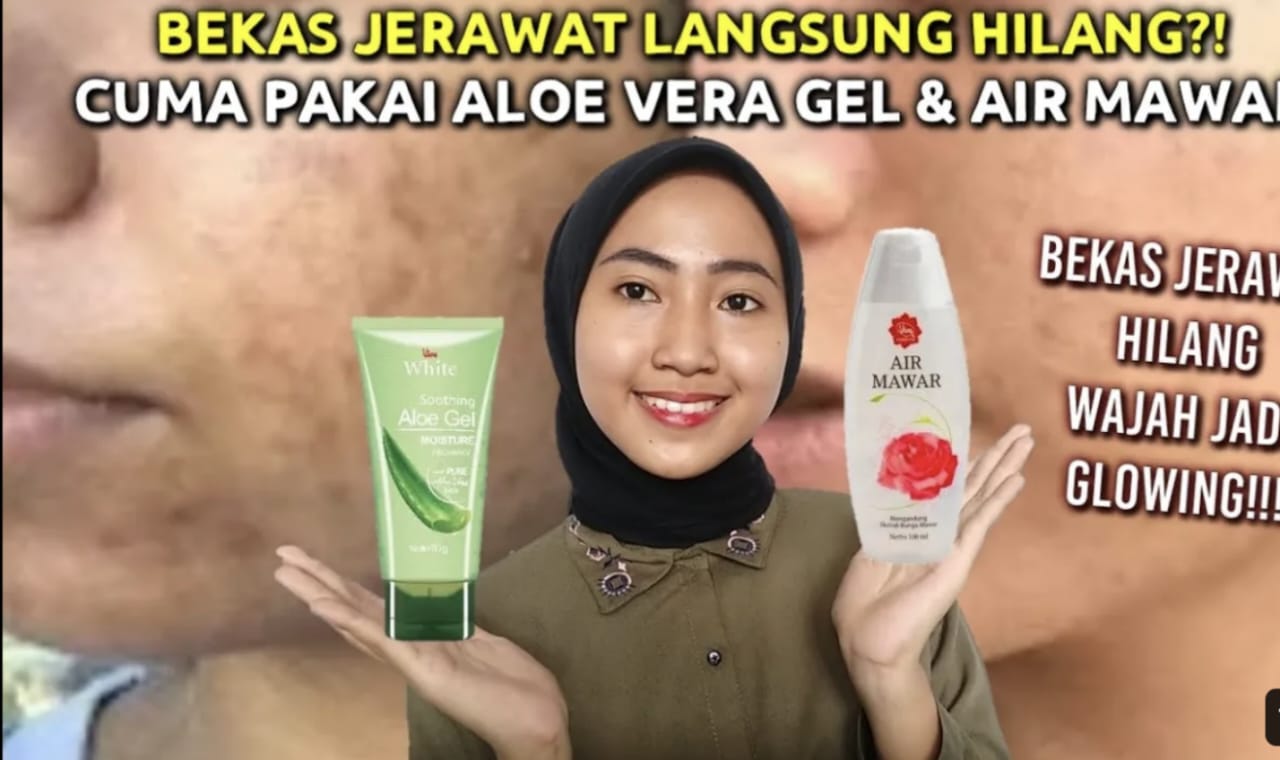 Raih Kulit Glowing Permanen dalam 1 Minggu dengan Air Mawar Viva dan Gel Lidah Buaya! Temukan Cara dan Panduannya di Sini