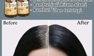 Temukan 4 Shampo untuk Meredakan Uban di Warung Terdekat! Harga Mulai Seribu Rupiah dengan Hasil Memukau pada Warna Rambut