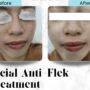Ternyata, Inilah 4 Produk Perawatan Kulit yang Efektif untuk Mengatasi Flek Hitam dan Mencerahkan Wajah!