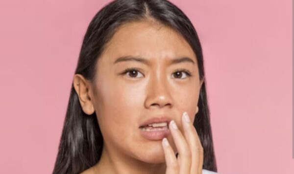 Tips Ampuh, 7 Cara Mengatasi Kulit Belang di Wajah dengan Efektif