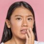 Tips Ampuh, 7 Cara Mengatasi Kulit Belang di Wajah dengan Efektif