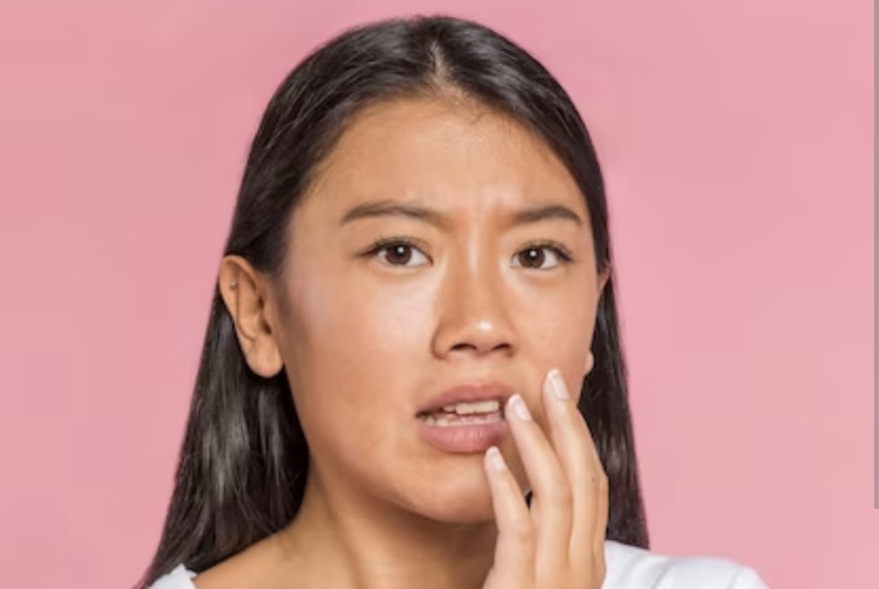 Tips Ampuh, 7 Cara Mengatasi Kulit Belang di Wajah dengan Efektif