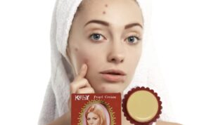 Tips Jitu Atasi Masalah Jerawat dengan Bedak Kelly! Campur dengan 1 Bahan Rahasia Ini, dan Hasilnya Akan Membuat Wajahmu Mulus dan Bening dengan Efektif!