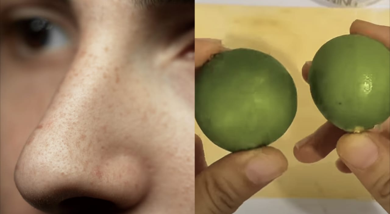 Tips Menghilangkan Flek Hitam dengan Jeruk Nipis agar Wajah Terlihat Bersih dan Cerah!