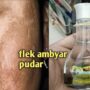 Tips Menghilangkan Flek Hitam dengan Masker Lidah Buaya dan Minyak Zaitun, Berikut 3 Cara Membuat Campurannya!