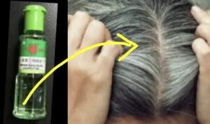 Ubah Rambut Beruban Tanpa Harus Mencabutnya! Inilah 3 Cara Menggunakan Minyak Kayu Putih untuk Mengatasi Uban dan Membuatnya Hilang Selamanya