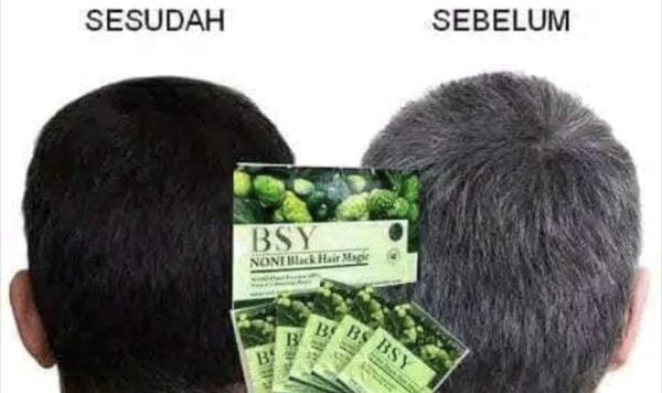 Cara Membedakan Shampo Noni Asli dan Palsu, Jangan Asal Beli