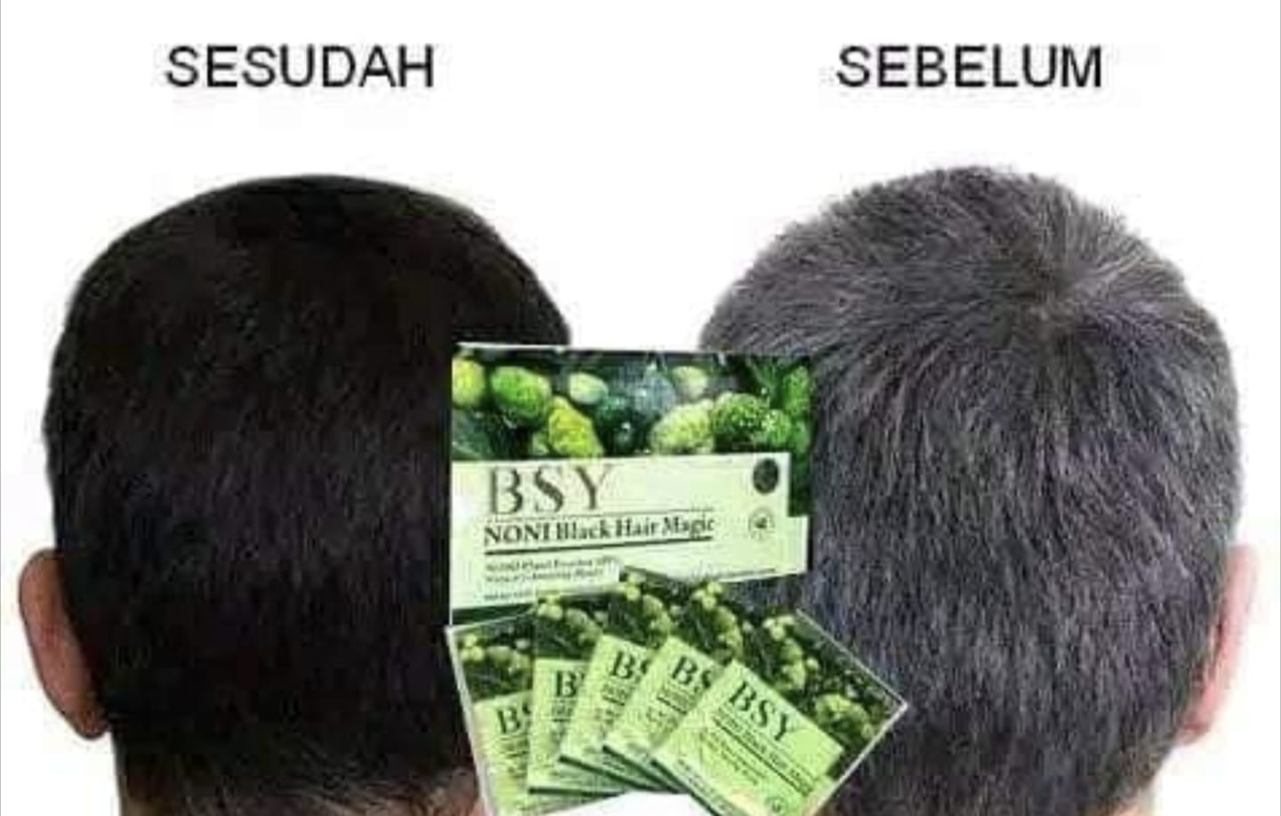 Cara Membedakan Shampo Noni Asli dan Palsu, Jangan Asal Beli