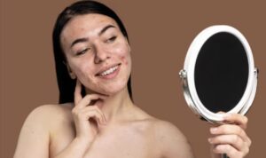 Panduan Lengkap, Cara Menghilangkan Flek Hitam dalam 1 Hari dengan Perawatan Kulit yang Tepat