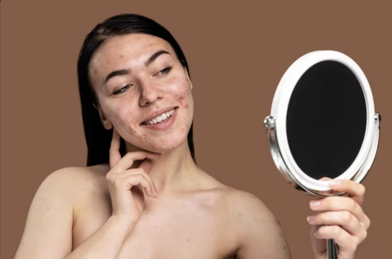 Panduan Lengkap, Cara Menghilangkan Flek Hitam dalam 1 Hari dengan Perawatan Kulit yang Tepat