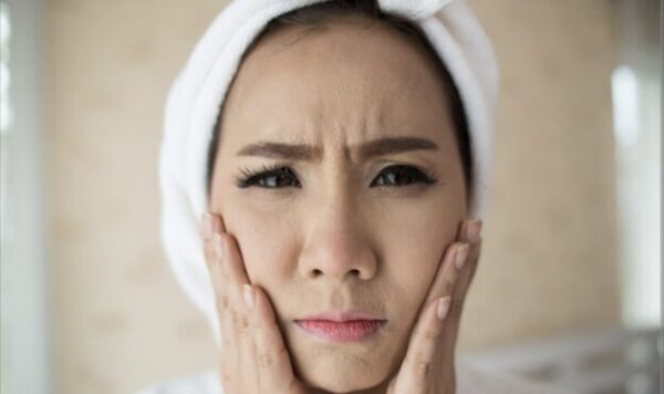 3 Arti Jerawat di Dagu dalam Percintaan, Ternyata Pesan dari Tubuh