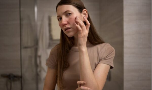 4 Arti Jerawat di Pipi Kanan dalam Percintaan, Apakah Baik atau Buruk?