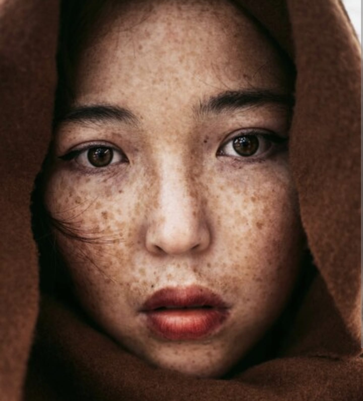 Cara Menghilangkan Flek Hitam di Wajah dengan Bawang Putih