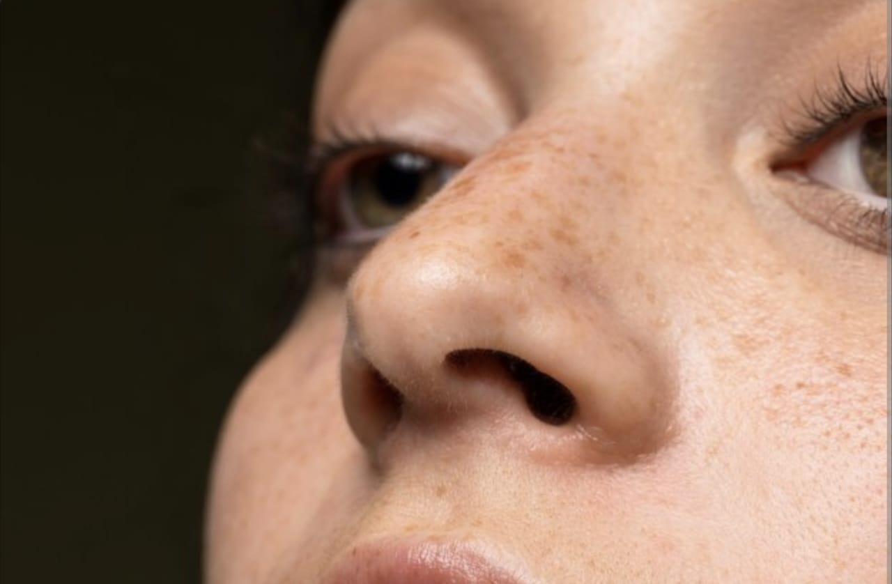 Cara Ngilangin Flek Hitam di Hidung