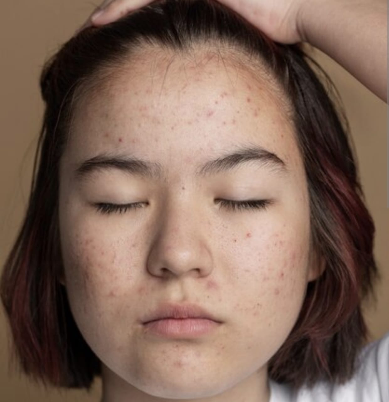 Kosmetik yang Menyebabkan Flek Hitam