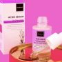 Efek Samping Scarlett Acne Serum