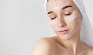 Ciri-Ciri Wajah Rusak Akibat Cream yang Berbahaya, Gunakan Cara Pencegahannya Disini