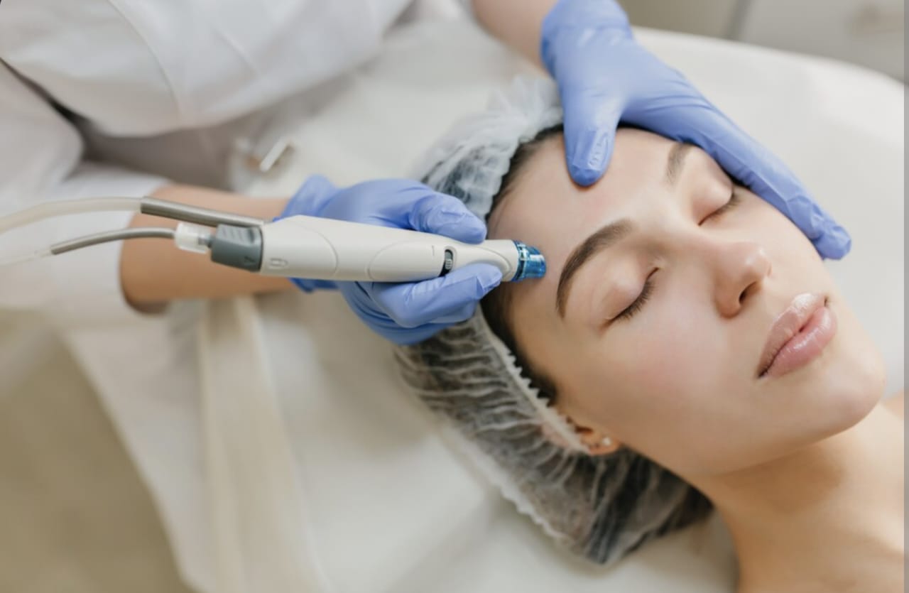 Berapa Biaya Laser untuk Menghilangkan Flek Hitam di Wajah