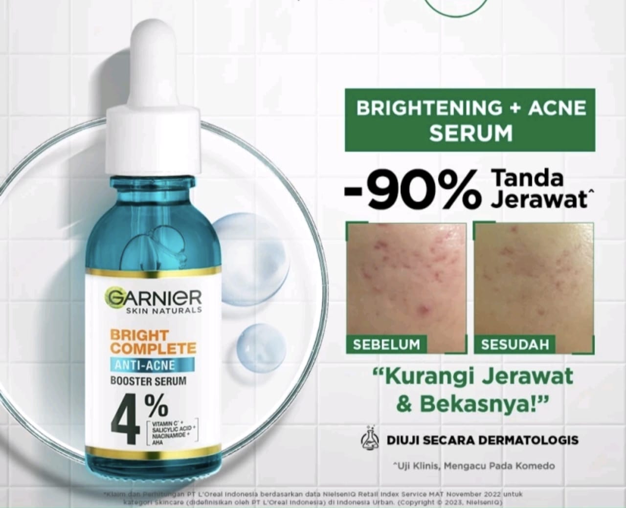 Cream Garnier untuk Kulit Berminyak dan Berjerawat