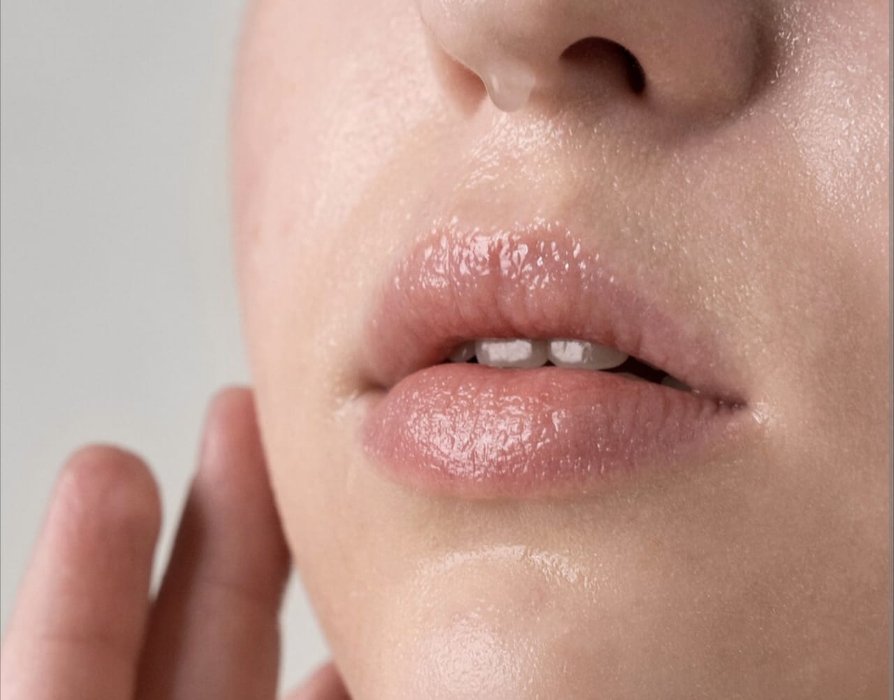 Bintik Putih di Bibir Seperti Jerawat