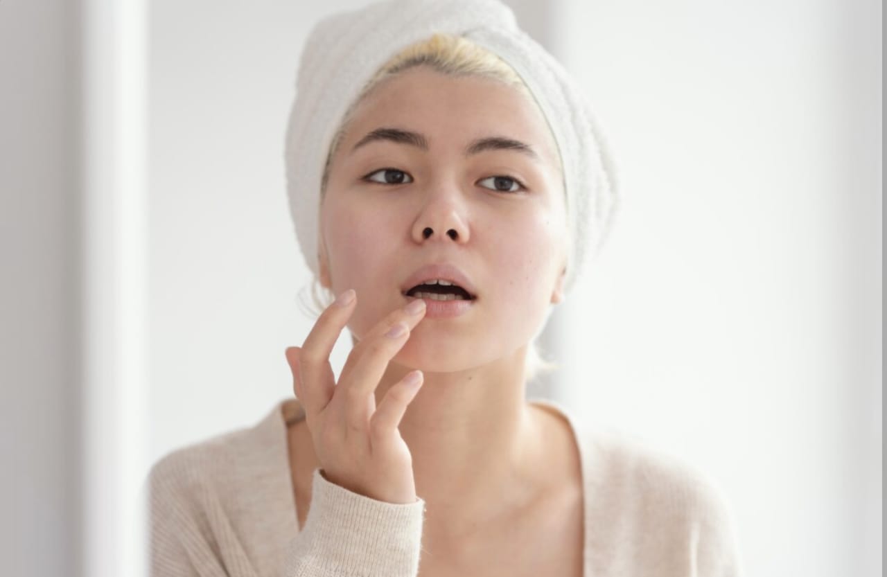 Bintik Putih di Bibir Seperti Jerawat