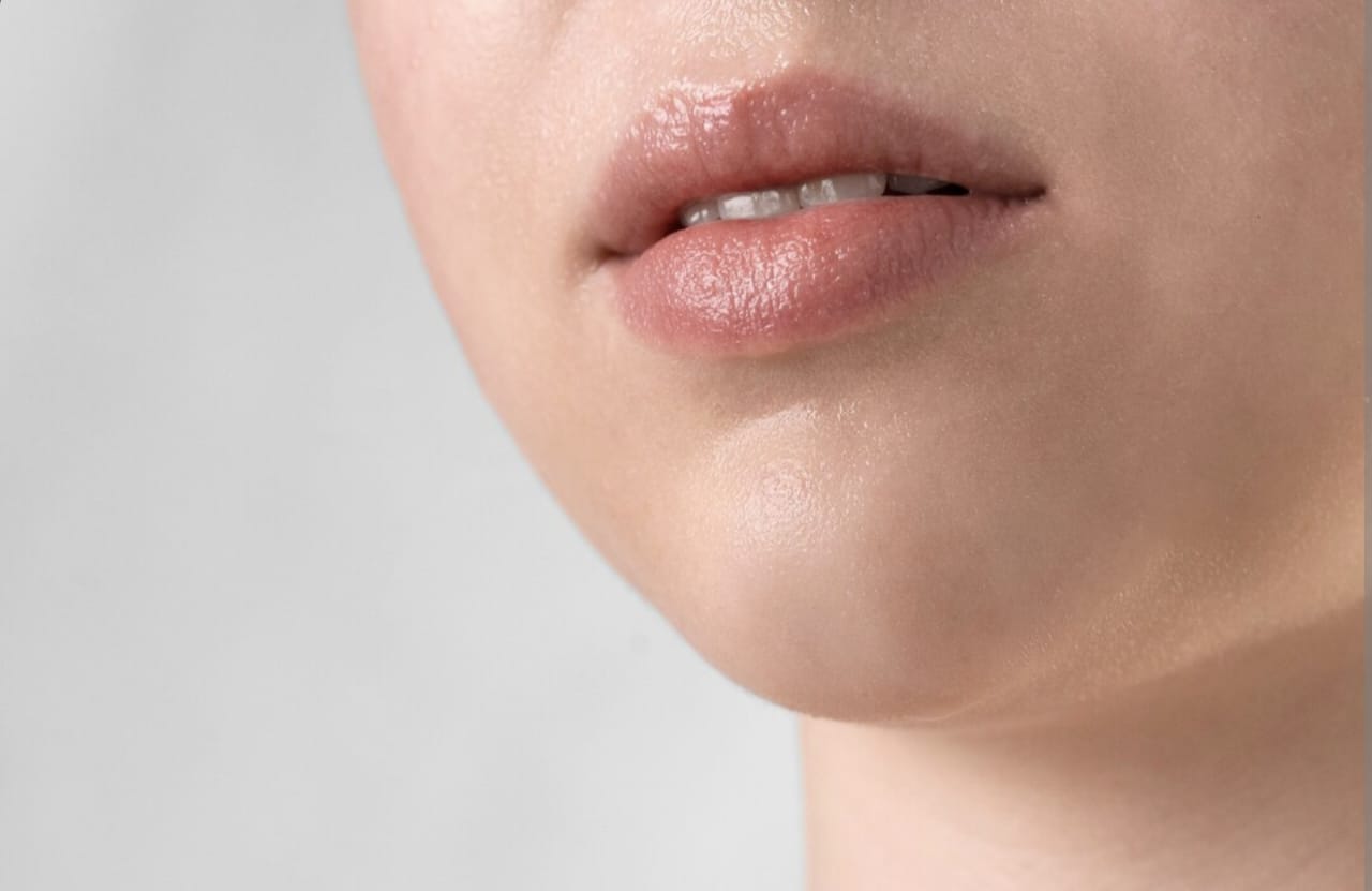 Bintik Putih di Bibir Seperti Jerawat