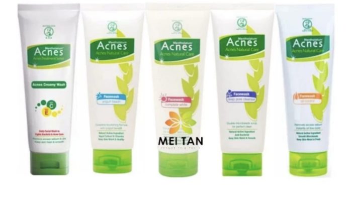 Krim Acnes untuk Memutihkan Wajah, Hasilnya Bikin Kaget!
