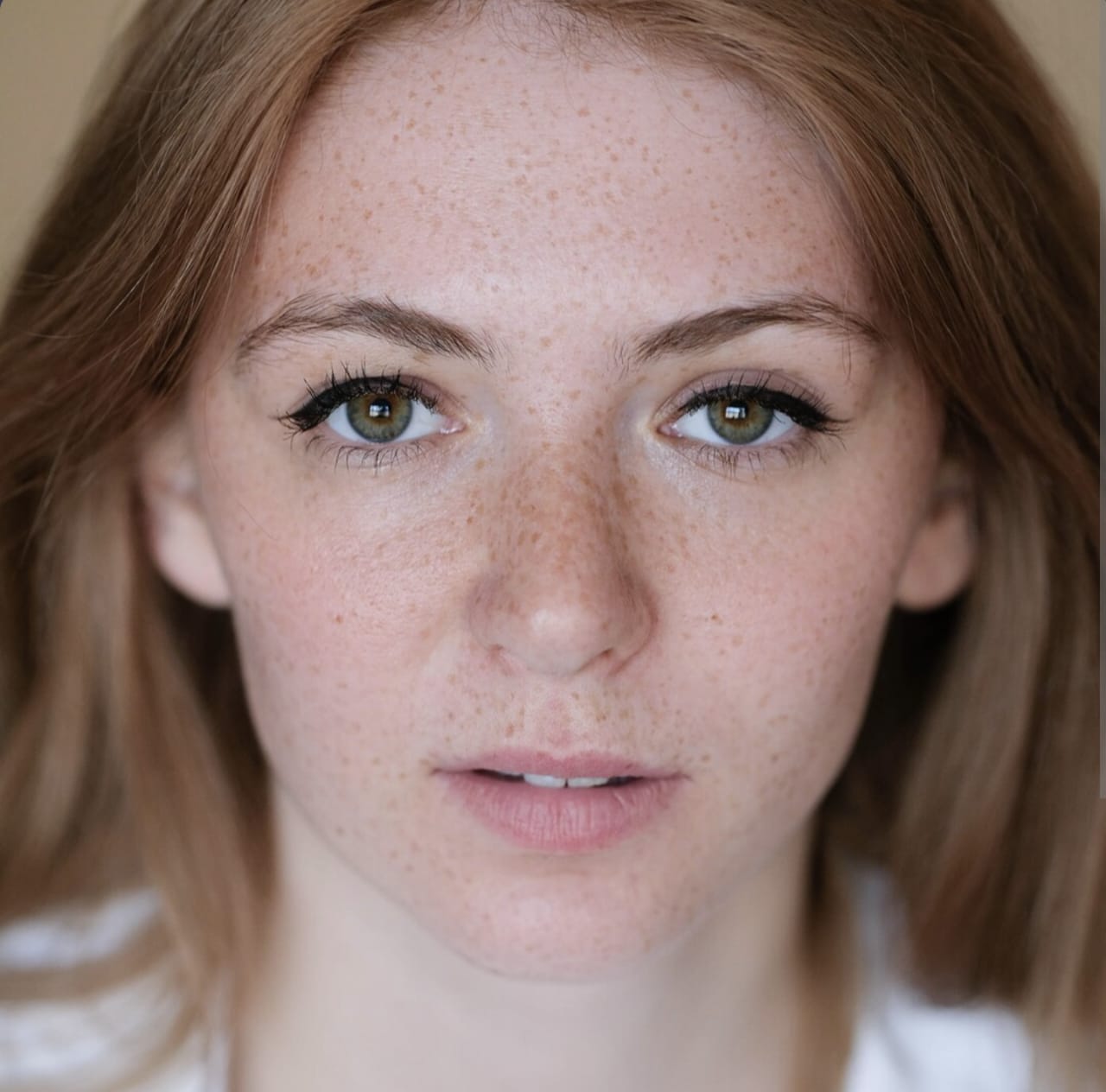 Cara Mengatasi Bercak Putih di Wajah